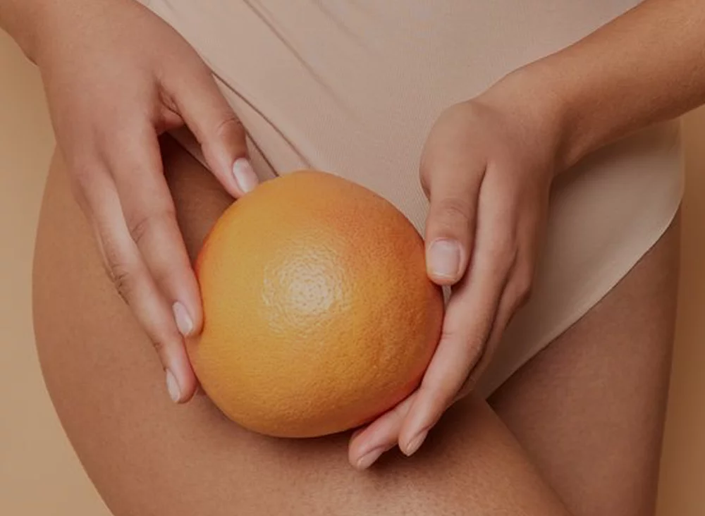 Cellulite: The Different Types And How To Treat It