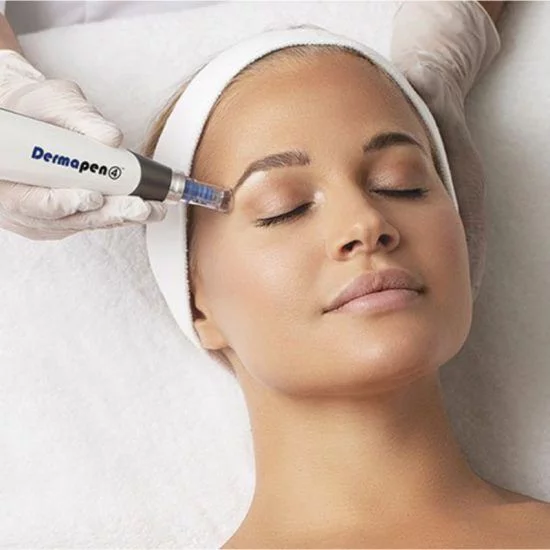 Learn more: Mesotherapy vs. Microneedling